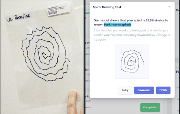 Digitized spiral test